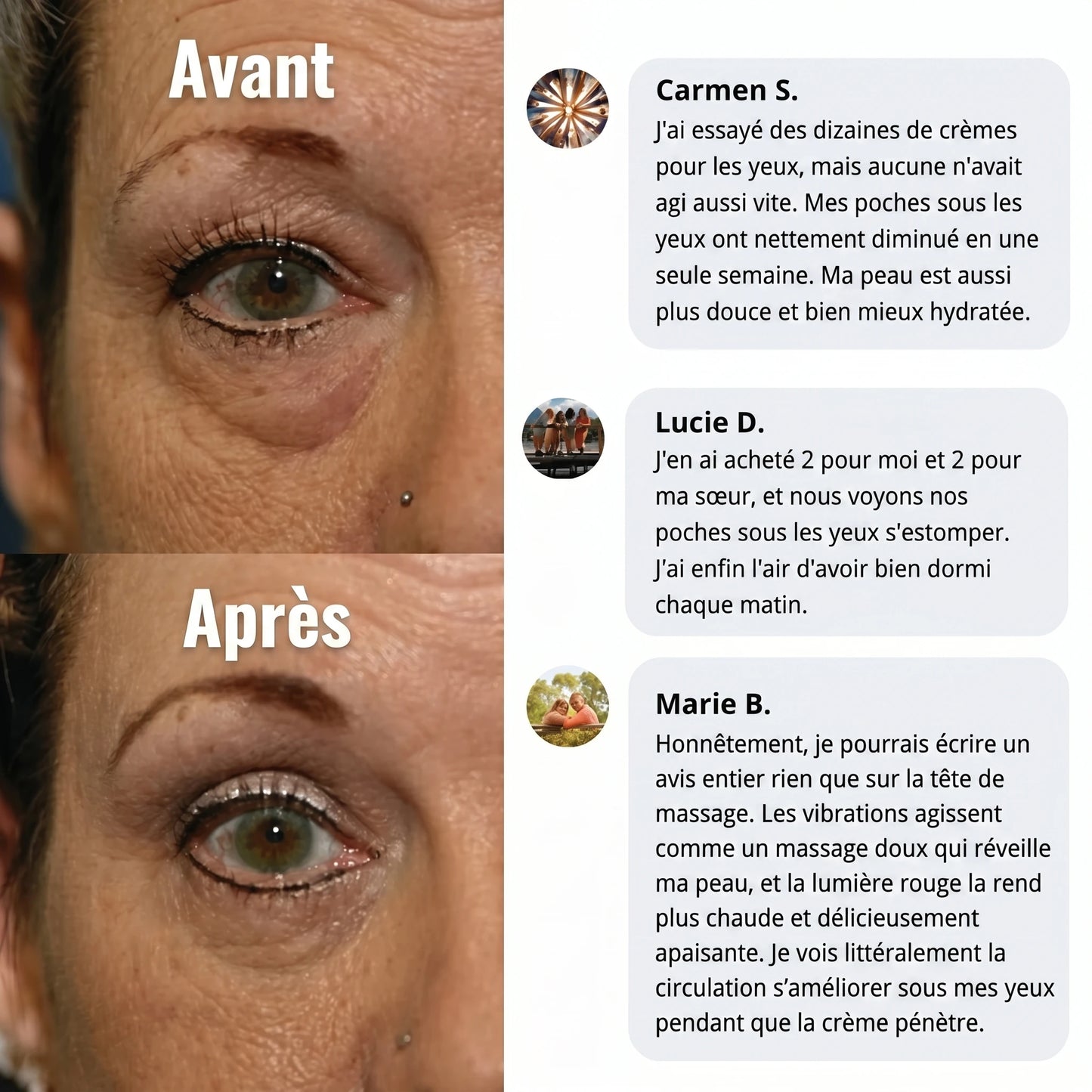 Avant / après et avis clientes du soin contour des yeux