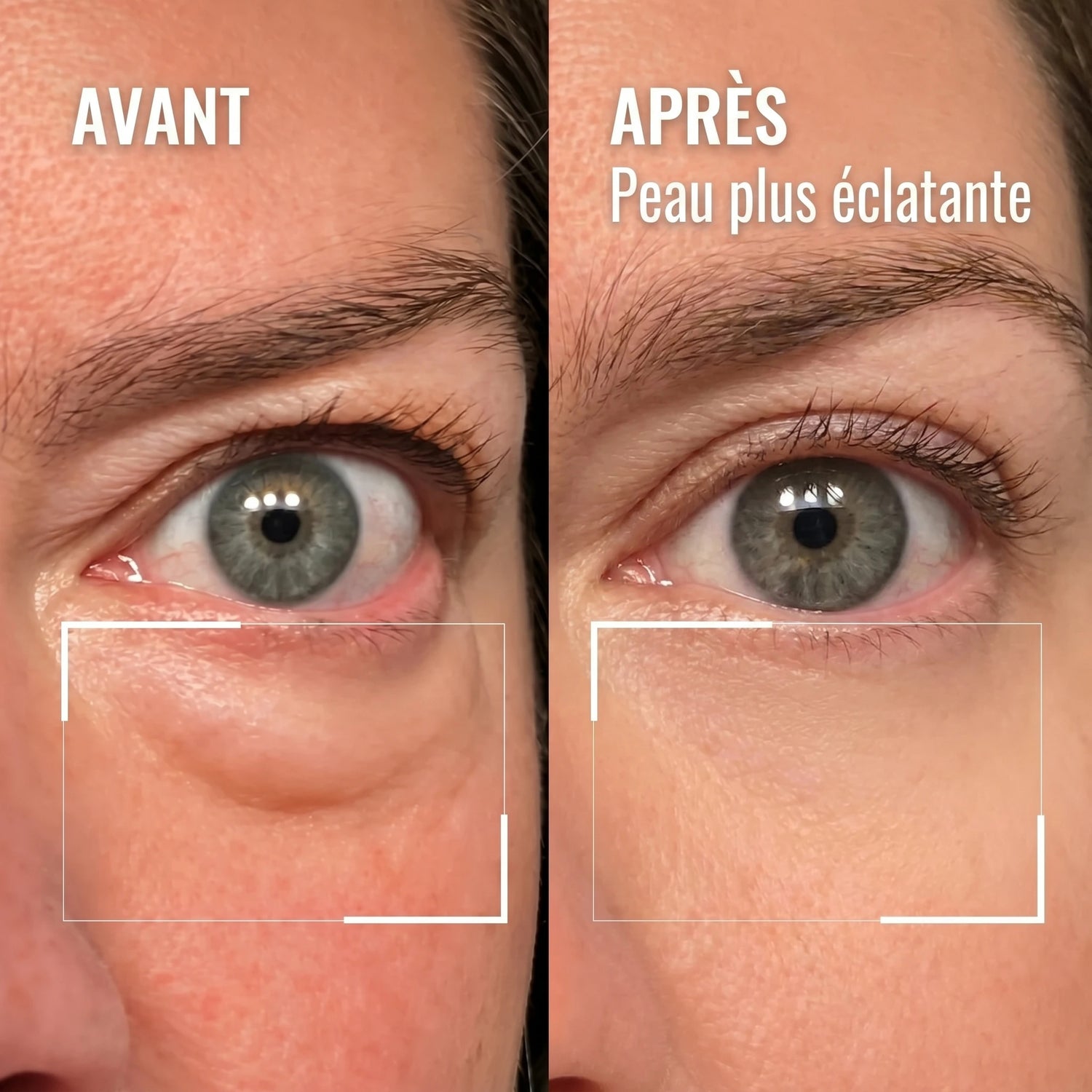 SUNEA 09_eye_closeup_ee4ca286-5c0f-4e84-8cfb-bb70bef74c11 FR