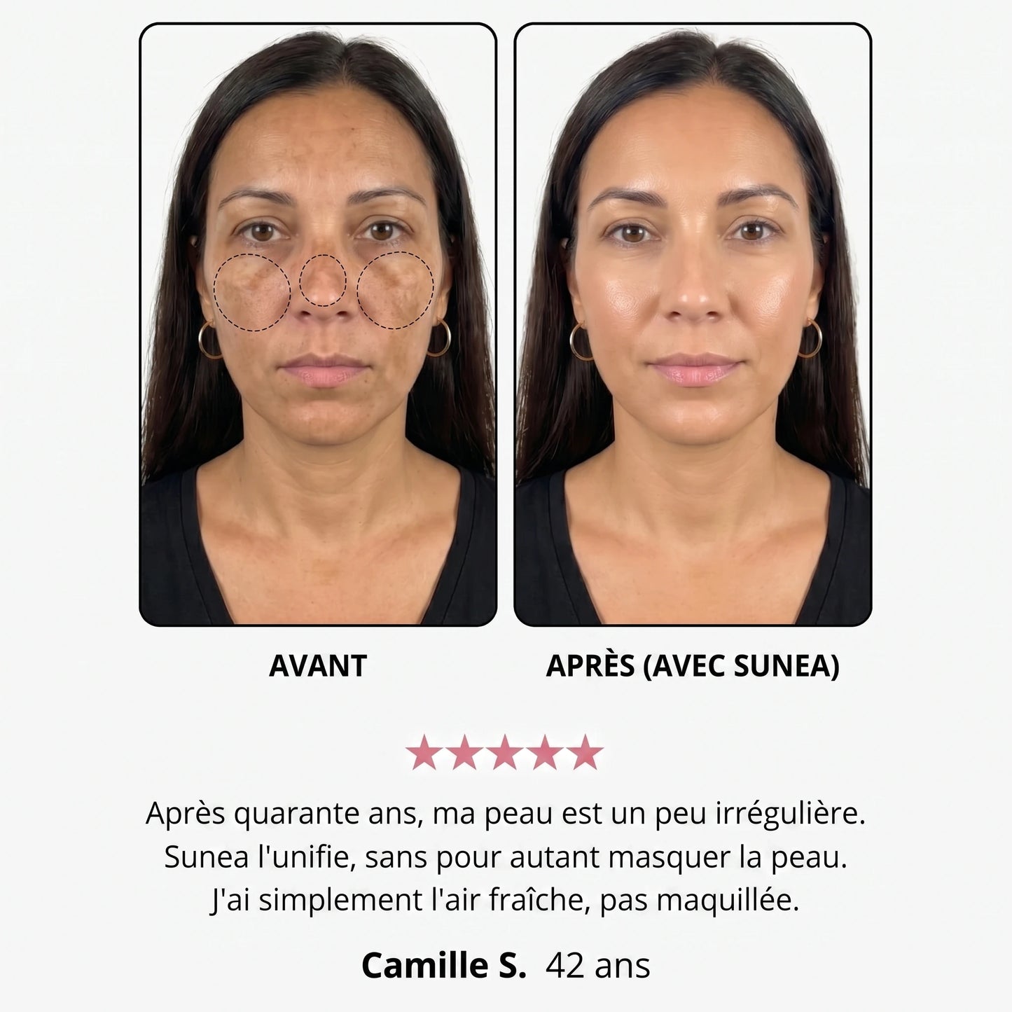 Avant / après — Hélène S., 42 ans