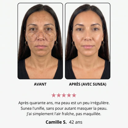 Avant / après — Hélène S., 42 ans