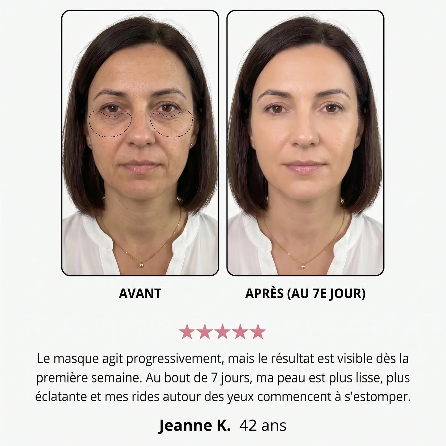 Avant / après — Jeanne K., 42 ans, au 7e jour