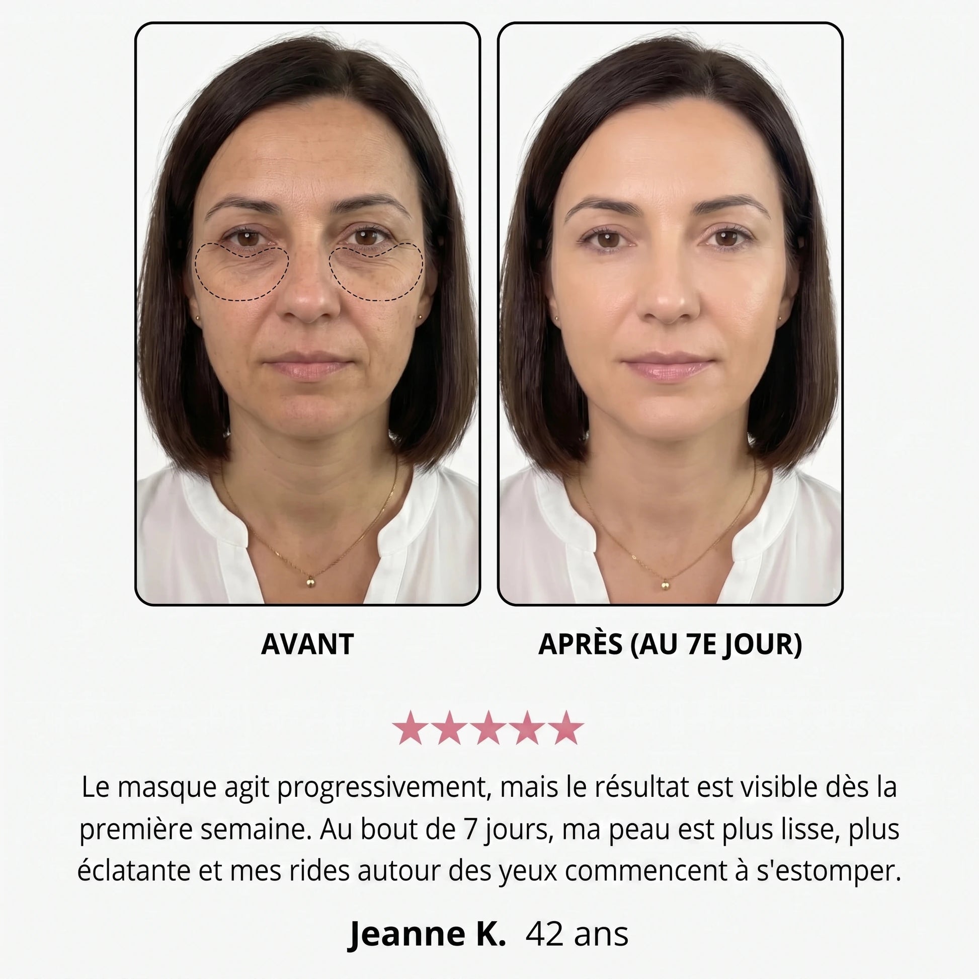 Avant / après — Jeanne K., 42 ans, au 7e jour