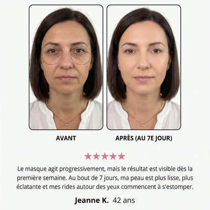Avant / après — Jeanne K., 42 ans, au 7e jour