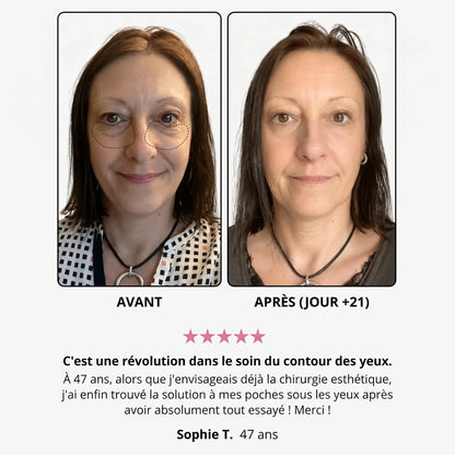 Avant / après (jour +21) — avis cliente sur le soin du contour des yeux