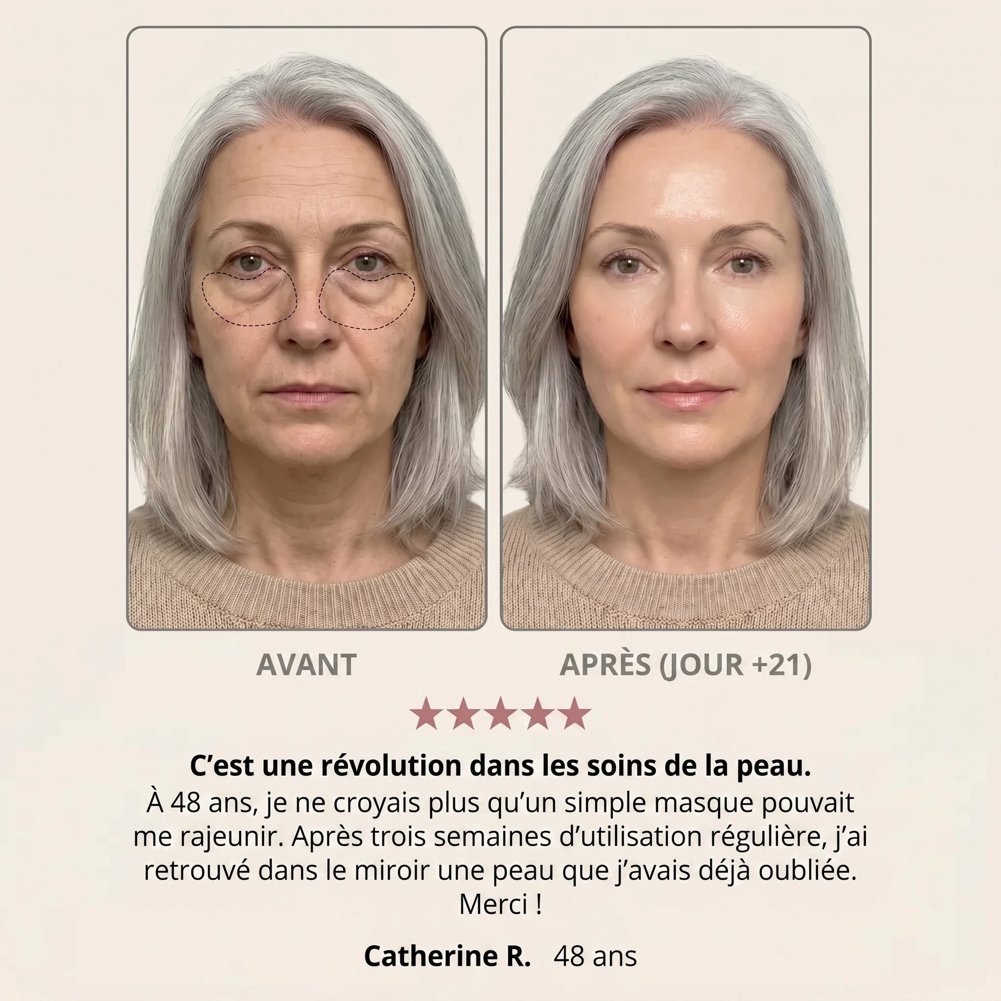 Avant / après — Pauline R., 48 ans, jour +21