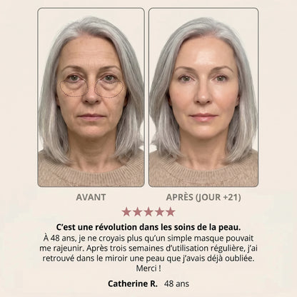 Avant / après — Pauline R., 48 ans, jour +21