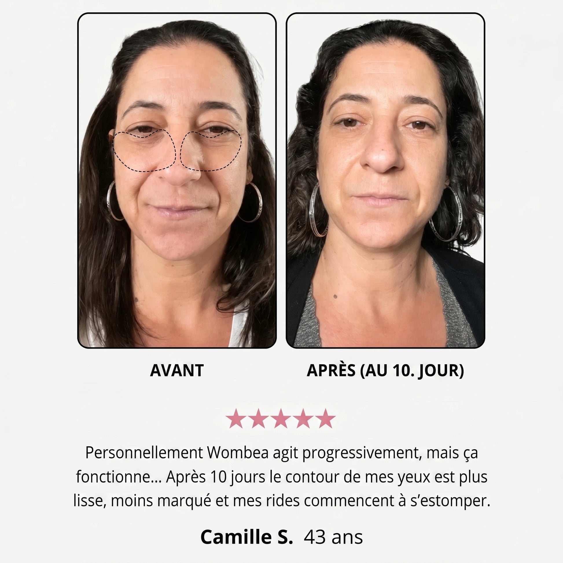 Avant / après (au 10e jour) — avis cliente, contour des yeux lissé