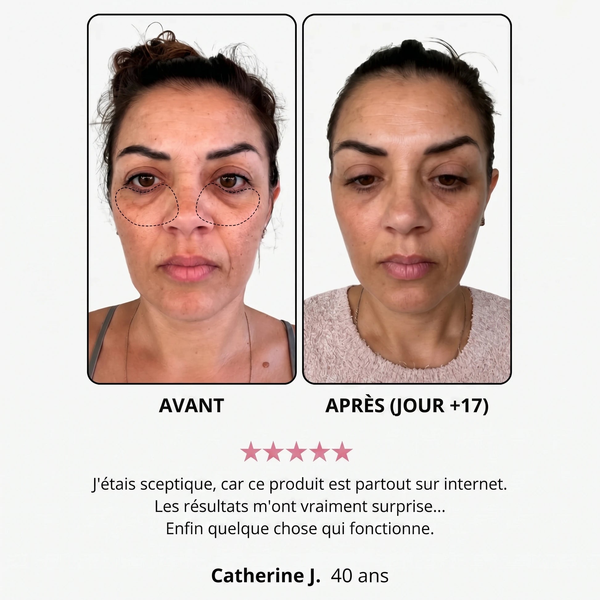 Avant / après (jour +17) — avis cliente, Catherine J., 40 ans