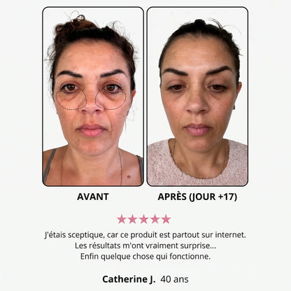 Avant / après (jour +17) — avis cliente, Catherine J., 40 ans