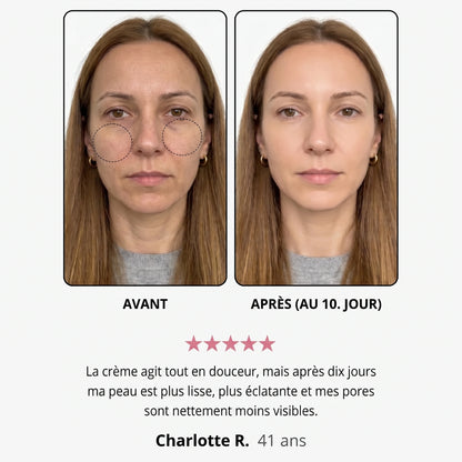 Avant / après — Sandrine R., 41 ans, au 10e jour