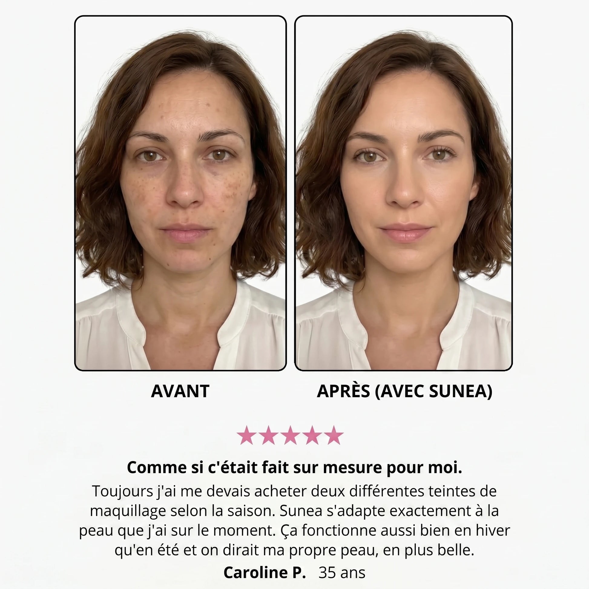 Avant / après — Caroline P., 35 ans
