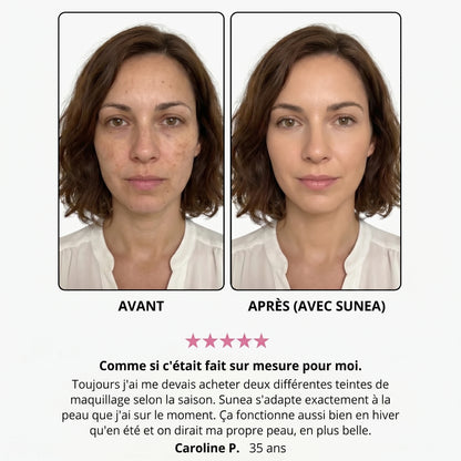 Avant / après — Caroline P., 35 ans