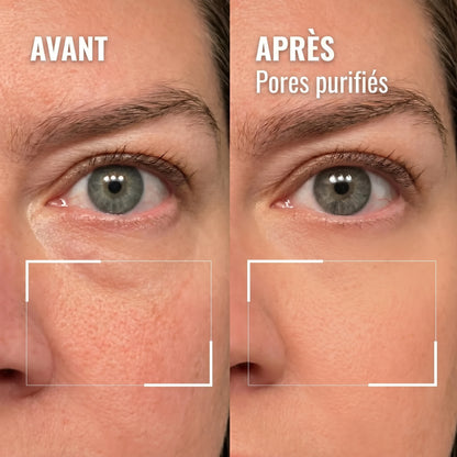 Détail du contour de l'œil — avant / après, pores purifiés