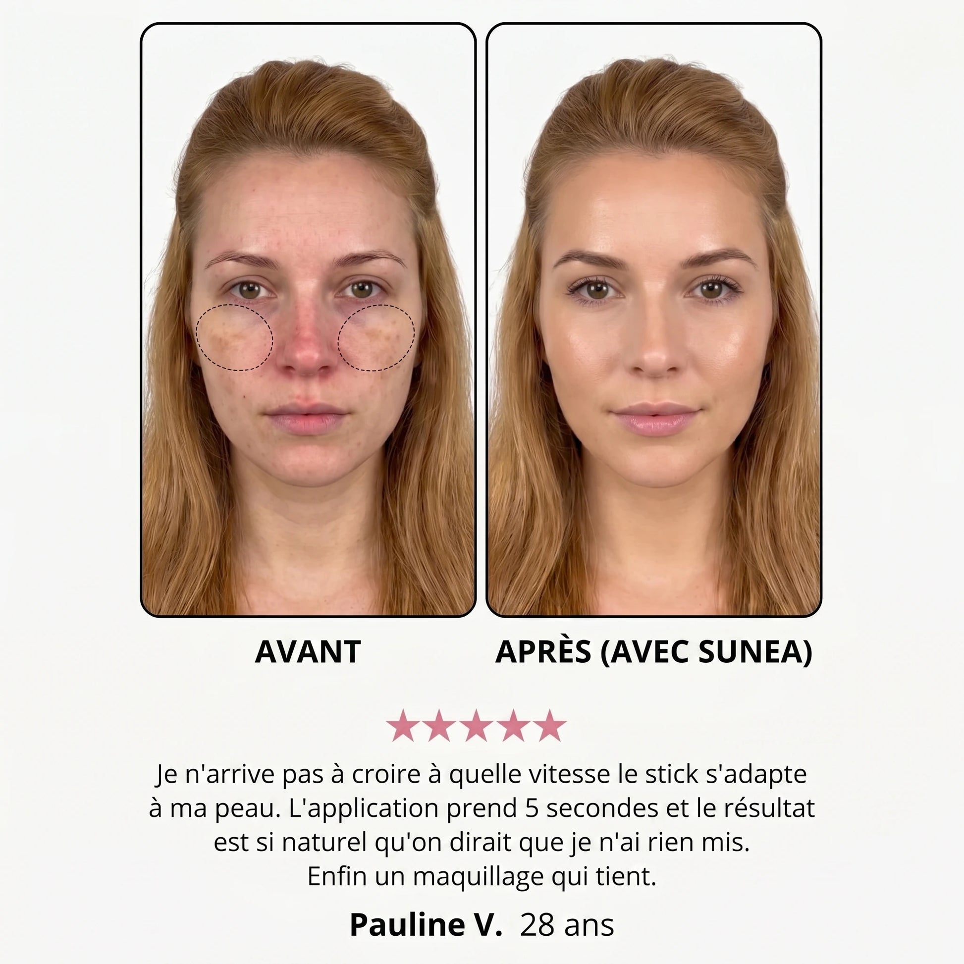 Avant / après — Dominique V., 28 ans