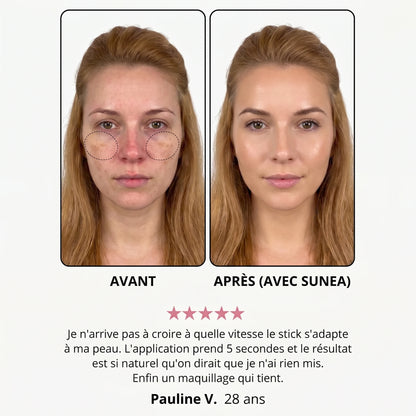 Avant / après — Dominique V., 28 ans