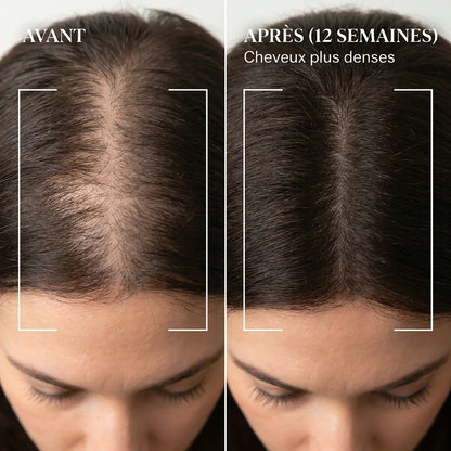 Sunea™ Sérum Capillaire au Peptide de Cuivre GHK-Cu