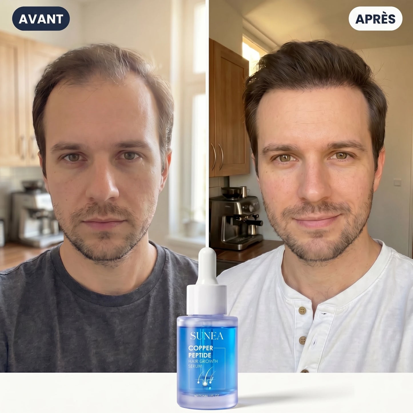 Sunea™ Sérum Capillaire au Peptide de Cuivre GHK-Cu