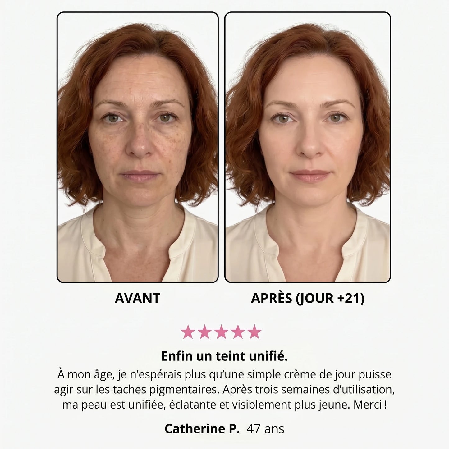 Avant / après — Danielle P., 47 ans, jour +21