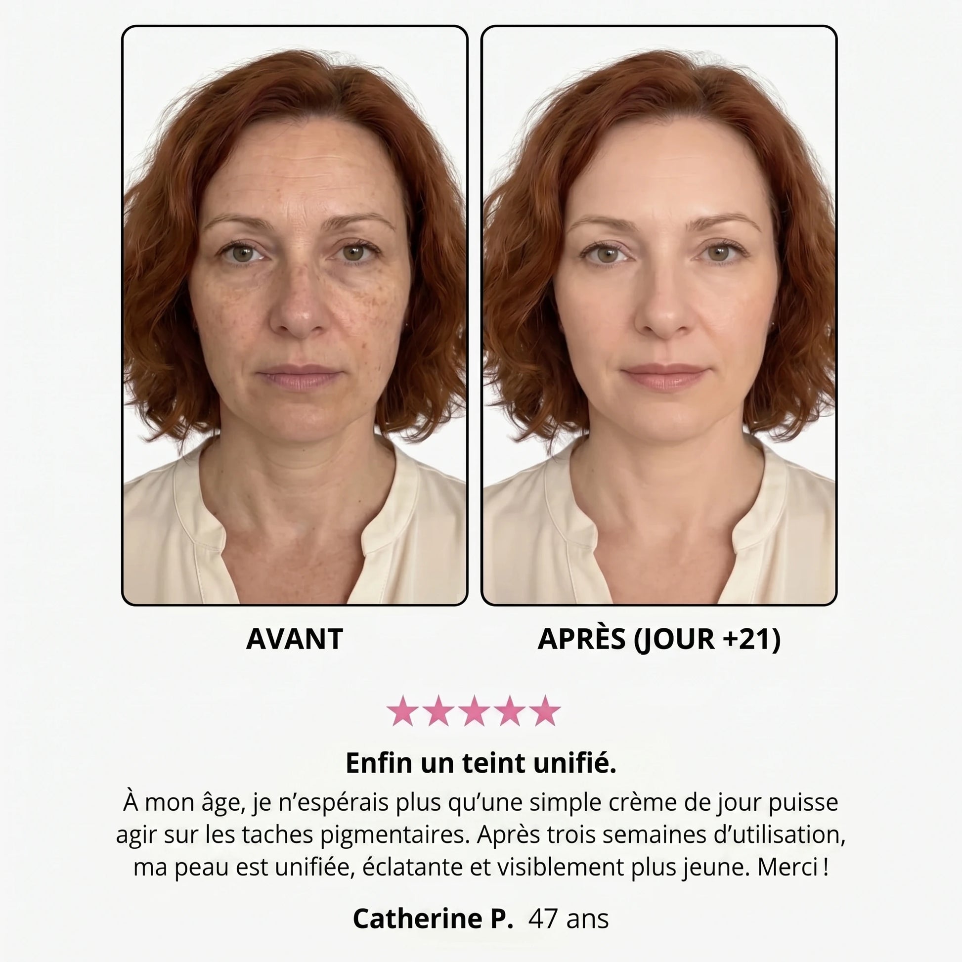 Avant / après — Danielle P., 47 ans, jour +21