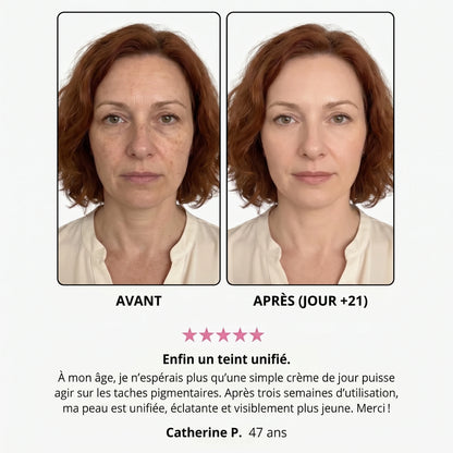 Avant / après — Danielle P., 47 ans, jour +21