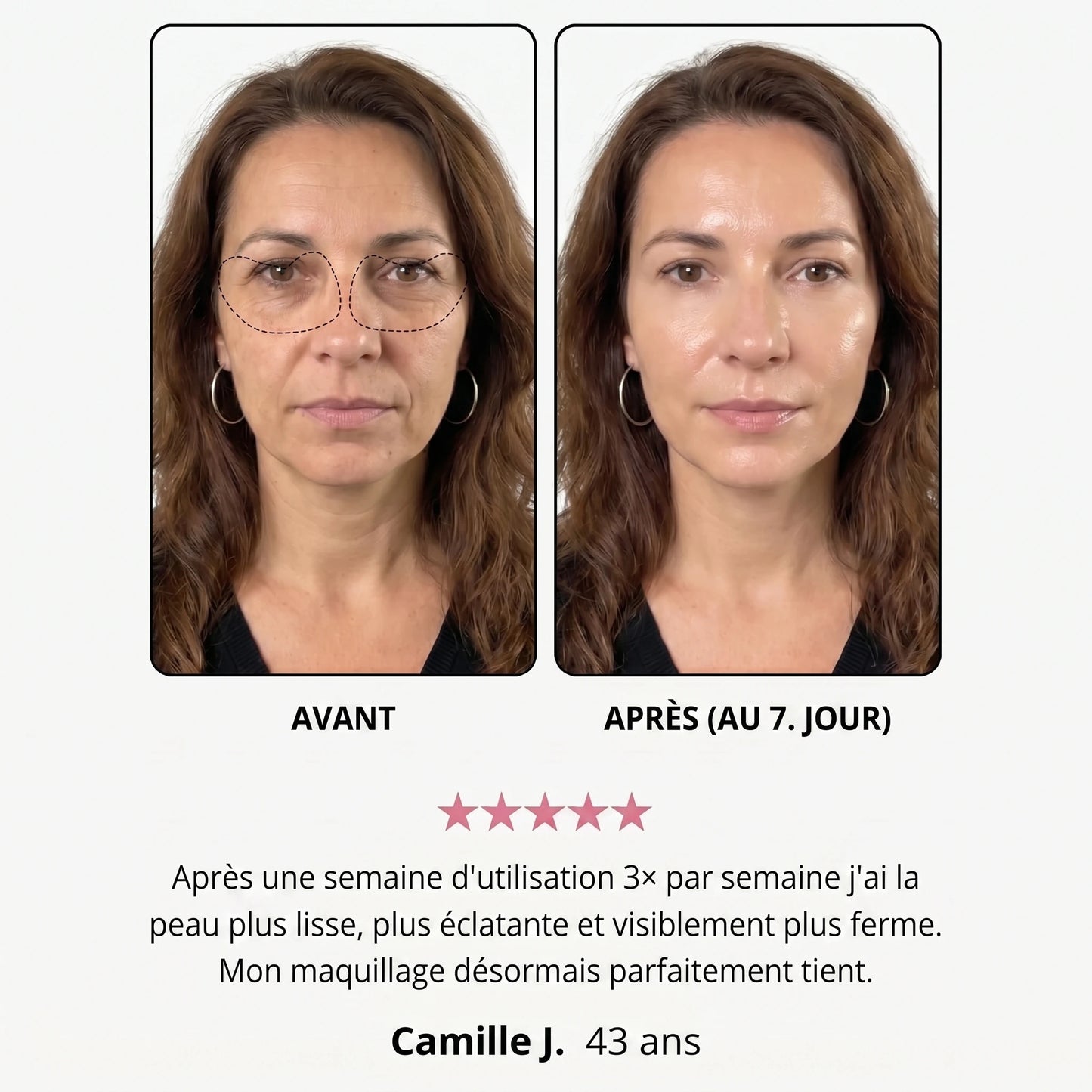 Avant / après — Manon J., 43 ans, au 7e jour