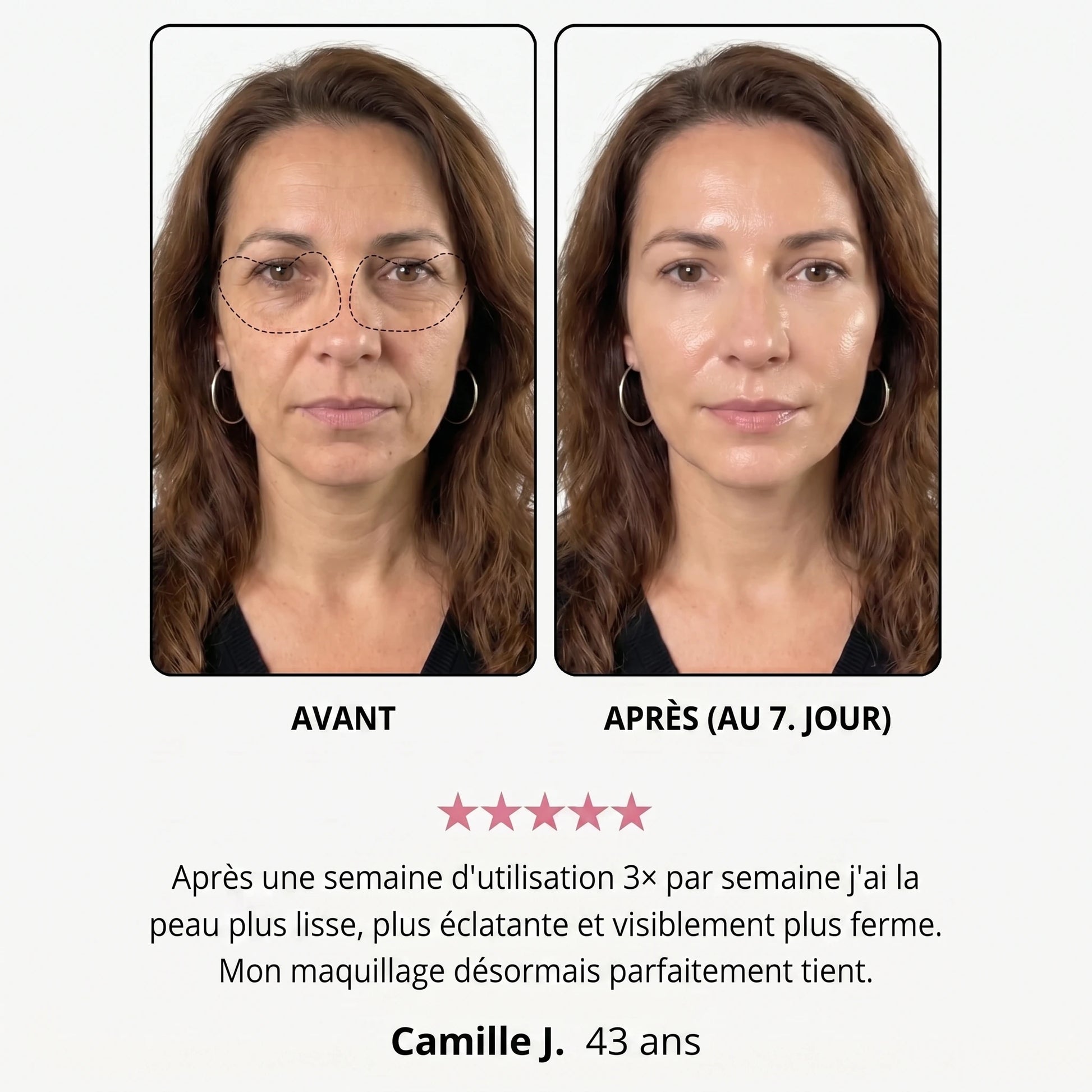 Avant / après — Manon J., 43 ans, au 7e jour