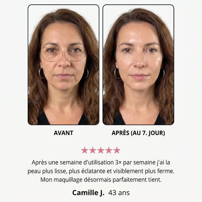Avant / après — Manon J., 43 ans, au 7e jour