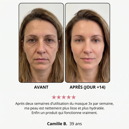 Avant / après — Léa B., 39 ans, jour +14