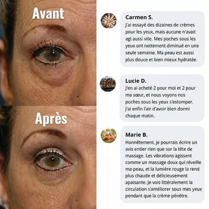 Avant / après et avis clientes du soin contour des yeux