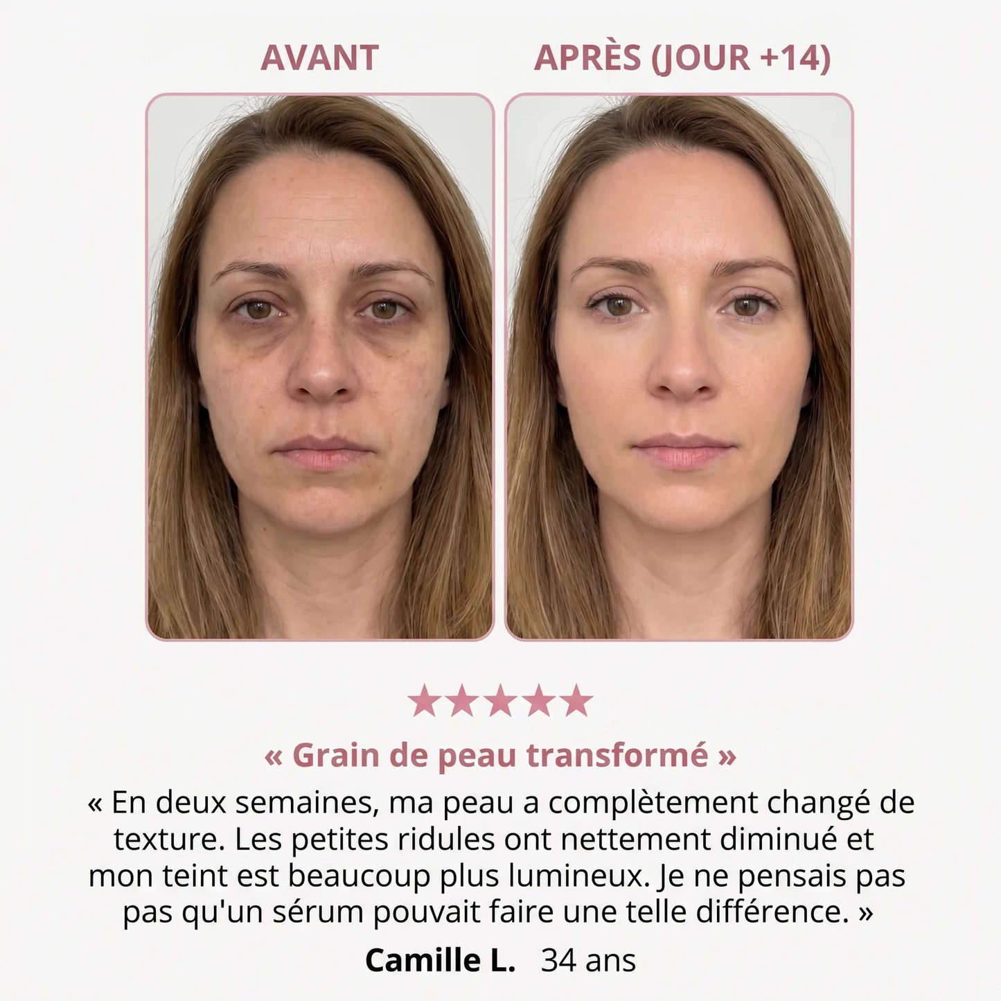 SUNEA sunea-pdrn-peptide-peptidove-serum-pro-obnovu-pleti-faayj · sunea-page-05.webp